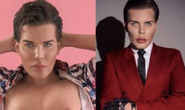 Il "Ken" umano rischia la vita dopo 42 interventi