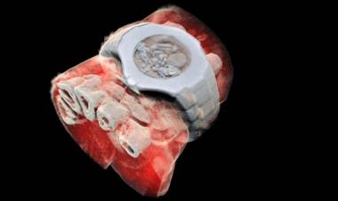 Prima radiografia in 3D a colori di un essere umano